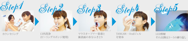 step1カウンセリング　step2口内洗浄（ピーリングスポンジ使用）　step3マウスオープナー装着と歯表面の水分拭き取り　step4TANGAN-Oralジェルを塗布　step5LED照射それ以降は3〜5の繰り返し